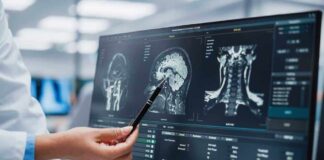 Doctor pointing at brain scans on a computer screen.