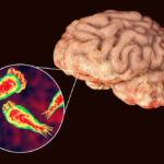 Brain with zoomed-in view of amoeba infection.