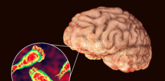 Brain with zoomed-in view of amoeba infection.