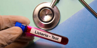 A gloved hand holding a blood test tube labeled 'Listeria - Test'