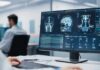 Doctor reviews brain MRI scans on a widescreen computer monitor