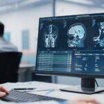 Doctor reviews brain MRI scans on a widescreen computer monitor