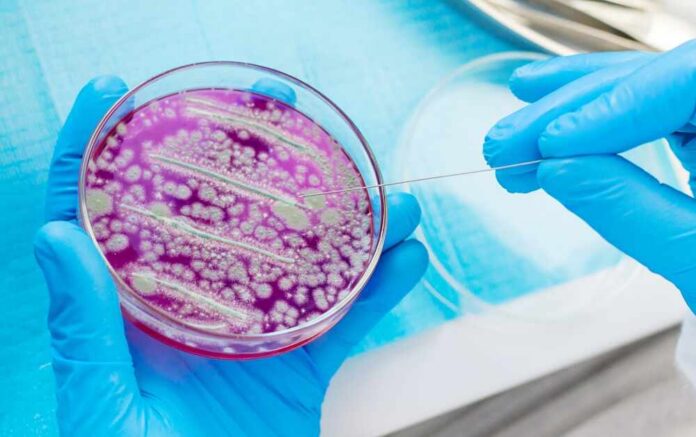 Examine,Bacteria,In,Petri,Dishes,In,The,Laboratory.,Selective,Focus. Scientist using a sterile tool to manipulate bacterial culture in a petri dish