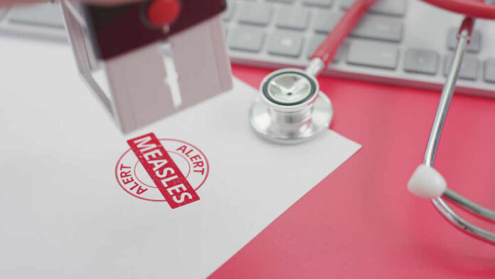 Putting,Measles,Alert,Stamp,On,The,Paper A stamp marking 'MEASLES ALERT' on a piece of paper next to a stethoscope and keyboard